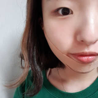 아이디플라코스메틱 아이디 페이스핏 마이너스 밴드 — 4점을 준 리뷰어가 2019년 10월 올린 사용 사진