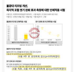 [스케덤] 상악밴드 — 4.5점을 준 리뷰어가 2019년 6월 올린 사용 사진