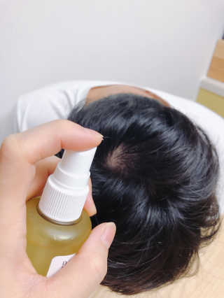 달리프 클로렐라 베러 루트 헤어토닉 100ml — 4점을 준 리뷰어가 2020년 1월 올린 사용 사진