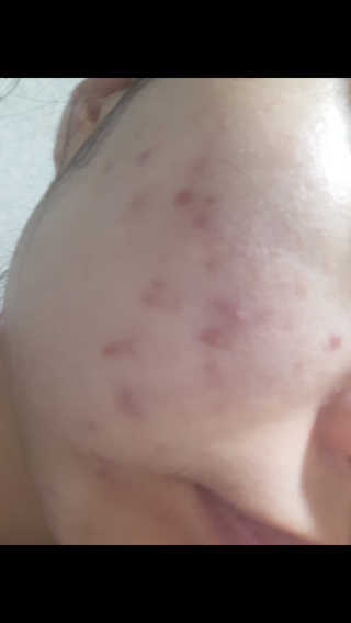 브에노 재생비비크림 — 3점을 준 리뷰어가 2017년 11월 올린 사용 사진