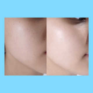 healsme님이 올린 리뷰 사진 4