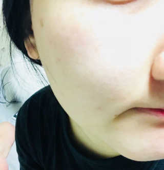 셀레뷰 슈퍼 모이스처 수딩젤 — 5점을 준 리뷰어가 2018년 3월 올린 사용 사진