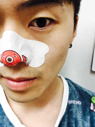 나이팅게일 TAKO PACK NOSE [문어코팩] — 4.5점을 준 리뷰어가 2016년 12월 올린 사용 사진