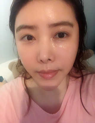 [더마허브] 주사팩 5종, 물광,백옥,태반,신데렐라 등 — 5점을 준 리뷰어가 2018년 2월 올린 사용 사진