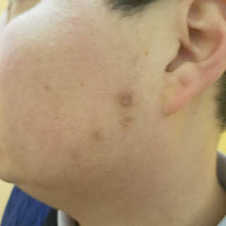 iamskinobsessed님이 올린 리뷰 사진 2