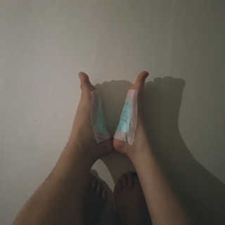 메디테라피 더마 릴렉스 힐링패치 — 4.17점을 준 리뷰어가 2018년 4월 올린 사용 사진