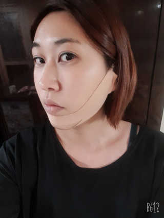 아이디플라코스메틱 아이디 페이스핏 마이너스 밴드 — 4점을 준 리뷰어가 2019년 11월 올린 사용 사진