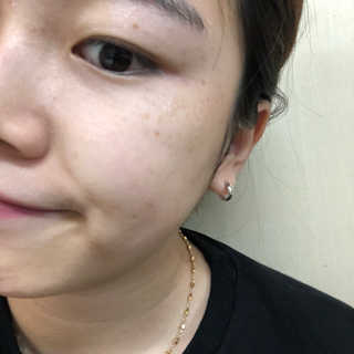 AHC 에이 에이치 씨 미니멀 10 워터리 에센스 — 3.5점을 준 리뷰어가 2018년 12월 올린 사용 사진