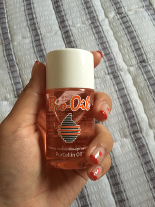 Bio-oil(바이오오일) 바이오오일(Bio-oil) — 4.5점을 준 리뷰어가 2016년 8월 올린 사용 사진