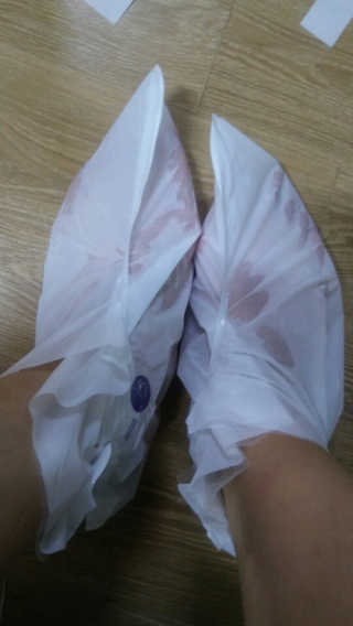 OMYLIFE Skin Freyia Foot Peeling — 5점을 준 리뷰어가 2018년 6월 올린 사용 사진
