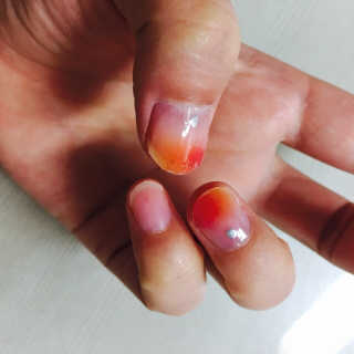 필린 릿티커 — 5점을 준 리뷰어가 2018년 10월 올린 사용 사진