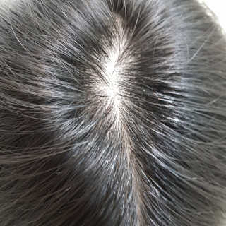 달리프 클로렐라 베러 루트 쿨링 스프레이 100ml — 4점을 준 리뷰어가 2019년 6월 올린 사용 사진