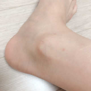 (주)에네스티 에네스티 수안수 실크스킨 풋크림 1+1 — 5점을 준 리뷰어가 2019년 11월 올린 사용 사진
