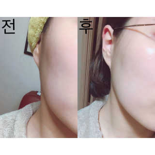 23years old 바데카실 세라3 오리지널 — 4.33점을 준 리뷰어가 2018년 3월 올린 사용 사진
