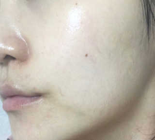 고보습에 화이트닝 아미모네 바다마스크팩 10매입 — 5점을 준 리뷰어가 2020년 1월 올린 사용 사진