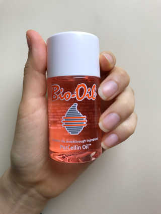Bio-oil(바이오오일) 바이오오일(Bio-oil) — 4.5점을 준 리뷰어가 2017년 1월 올린 사용 사진