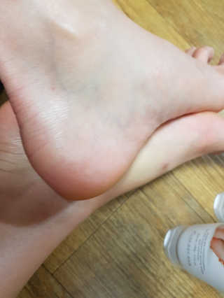 (주)에네스티 에네스티 수안수 실크스킨 풋크림 1+1 — 4점을 준 리뷰어가 2019년 11월 올린 사용 사진