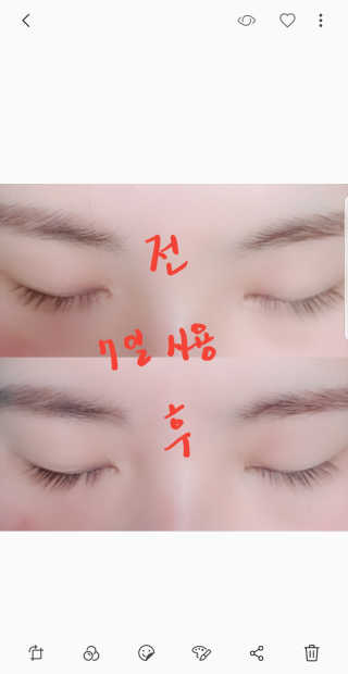 에이페 아이래쉬 리치 세럼 — 5점을 준 리뷰어가 2018년 6월 올린 사용 사진