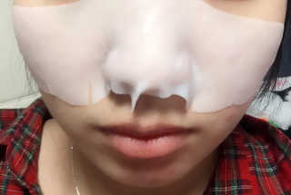 나이팅게일 3STEP 타코팩(문어팩) — 3점을 준 리뷰어가 2017년 2월 올린 사용 사진