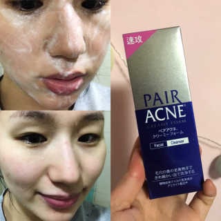 페어아크네 크리미폼 페어아크네 크리미 폼 — 3.5점을 준 리뷰어가 2019년 7월 올린 사용 사진