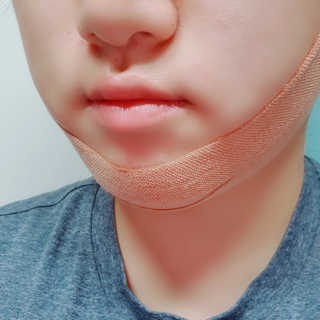아이디플라코스메틱 아이디 페이스핏 마이너스 밴드 — 4점을 준 리뷰어가 2020년 3월 올린 사용 사진