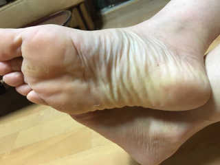 OMYLIFE Skin Freyia Foot Peeling — 2점을 준 리뷰어가 2018년 6월 올린 사용 사진