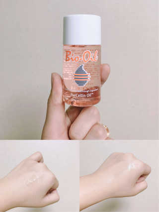 Bio-oil(바이오오일) 바이오오일 — 4.5점을 준 리뷰어가 2016년 10월 올린 사용 사진