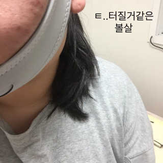 메디미 브이미 업 2스텝 브이라인벨트 — 5점을 준 리뷰어가 2017년 10월 올린 사용 사진