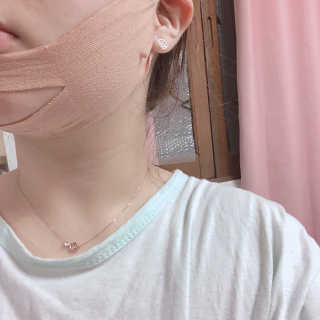 아이디플라코스메틱 아이디 페이스핏 마이너스 밴드 — 5점을 준 리뷰어가 2019년 12월 올린 사용 사진