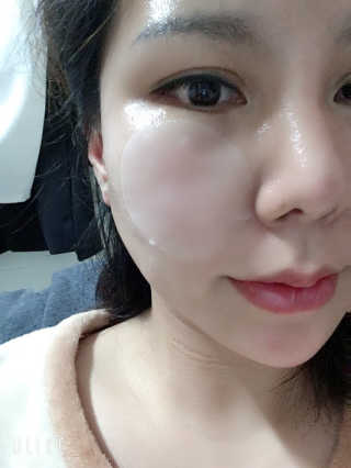 자이엘 S.O.S 레드 칙 케어팩 2 Box — 4점을 준 리뷰어가 2019년 10월 올린 사용 사진