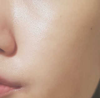 23years old 징크놀 — 3.33점을 준 리뷰어가 2017년 8월 올린 사용 사진