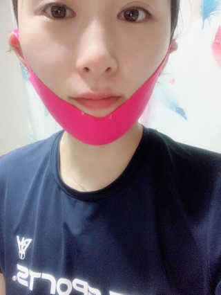스케덤 펩타이드 리프팅밴드 — 4점을 준 리뷰어가 2019년 3월 올린 사용 사진