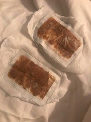 메디테라피 더마 릴렉스 힐링패치 — 5점을 준 리뷰어가 2018년 4월 올린 사용 사진