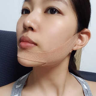 아이디플라코스메틱 아이디 페이스핏 마이너스 밴드 — 5점을 준 리뷰어가 2019년 9월 올린 사용 사진