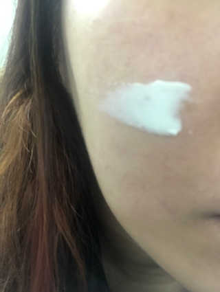 블랙모어스 내츄럴 비타민 E 크림 — 5점을 준 리뷰어가 2018년 3월 올린 사용 사진