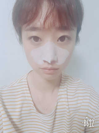나이팅게일 TAKO PACK NOSE [문어코팩] — 5점을 준 리뷰어가 2018년 5월 올린 사용 사진