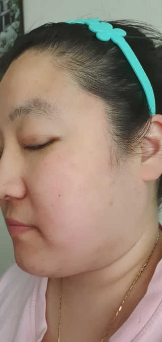 스킨더마 날씬마녀 화이트닝 모이스처크림 — 5점을 준 리뷰어가 2019년 12월 올린 사용 사진