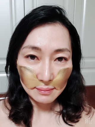 [스케덤] 상악밴드 — 5점을 준 리뷰어가 2019년 6월 올린 사용 사진
