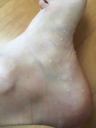 아미니 릴렉싱 풋 필링 스프레이 — 5점을 준 리뷰어가 2019년 4월 올린 사용 사진