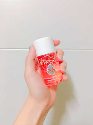 Bio-oil(바이오오일) 바이오오일 — 3점을 준 리뷰어가 2016년 10월 올린 사용 사진