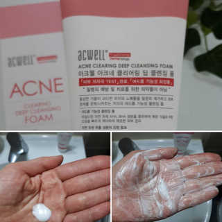 아크웰 아크네 클리어링 딥 클렌징 폼 — 5점을 준 리뷰어가 2018년 11월 올린 사용 사진