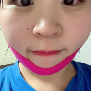 스케덤 펩타이드 리프팅밴드 — 3점을 준 리뷰어가 2019년 2월 올린 사용 사진