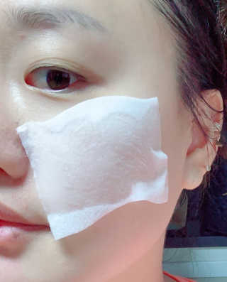토모토끼 아이메이징 앰플 트리트먼트 스페셜 세트 — 5점을 준 리뷰어가 2019년 10월 올린 사용 사진