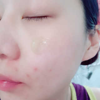 타임인네이처 [더메디닥터] 카렌듈라 엔자임 필링젤 — 5점을 준 리뷰어가 2019년 2월 올린 사용 사진