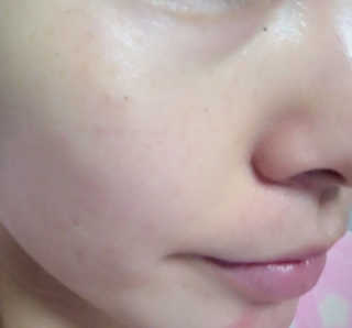 23years old 블랙캐비디올마스크 — 4점을 준 리뷰어가 2016년 12월 올린 사용 사진