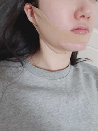 아이디플라코스메틱 아이디 페이스핏 마이너스 밴드 — 4점을 준 리뷰어가 2019년 12월 올린 사용 사진