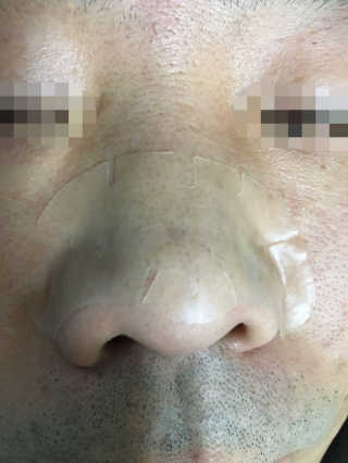 메디힐 슬리핑 멜팅 코팩 — 5점을 준 리뷰어가 2020년 1월 올린 사용 사진