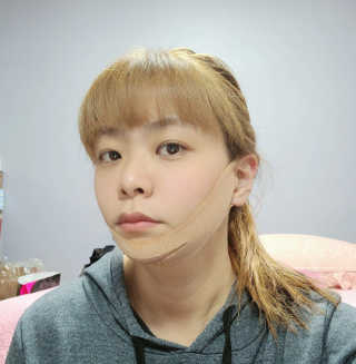 아이디플라코스메틱 아이디 페이스핏 마이너스 밴드 — 5점을 준 리뷰어가 2020년 3월 올린 사용 사진
