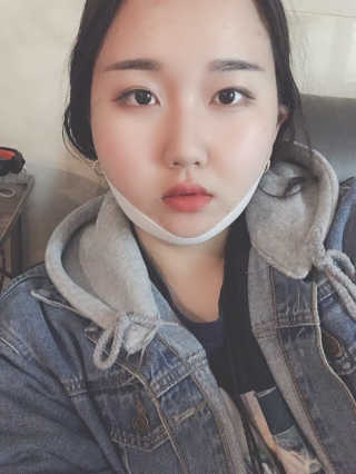 스케덤 클루덤 리프팅 패치 — 4점을 준 리뷰어가 2019년 4월 올린 사용 사진
