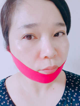 스케덤 펩타이드 리프팅밴드 — 5점을 준 리뷰어가 2019년 7월 올린 사용 사진